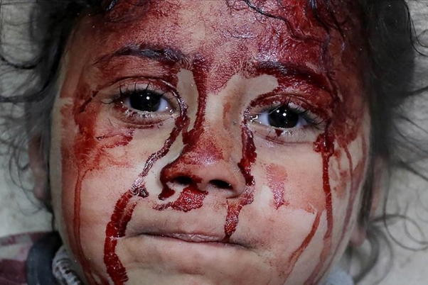 الأمم المتحدة : عدد قتلى أطفال غزة يفوق نظراءهم بحروب العالم آخر 4 سنوات