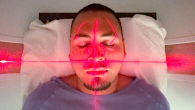 توصلت الدراسة إلى أن التأثير السيئ الناجم عن السرطان حقيقي