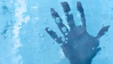 روسيا.. إنعاش رجل بعد 5 ساعات من الموت السريري بسبب البرد القارس