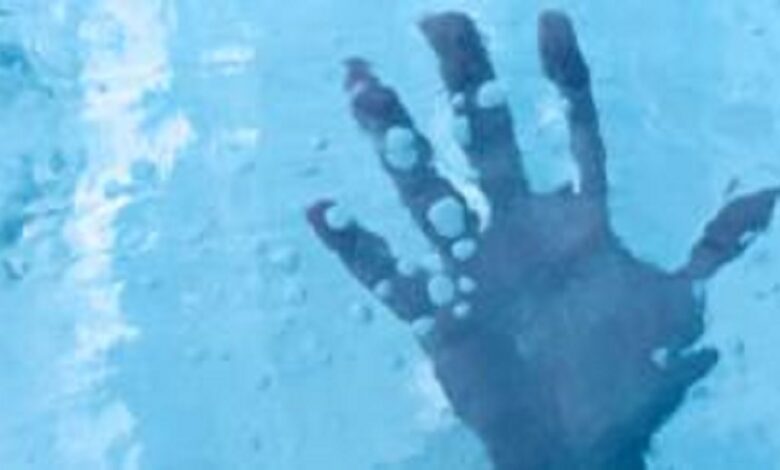 روسيا.. إنعاش رجل بعد 5 ساعات من الموت السريري بسبب البرد القارس