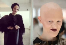 ميلاني جايدوس.. عارضة أزياء كسرت معايير الجمال التقليدية وألهمت العالم