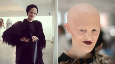 ميلاني جايدوس.. عارضة أزياء كسرت معايير الجمال التقليدية وألهمت العالم