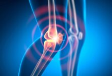 Knee Joint Pain Arthritis
