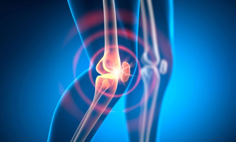 Knee Joint Pain Arthritis