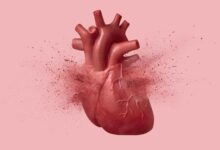 Heart Exploding Cardiology Attach Disease