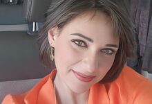 نورهان تثير قلق جمهورها بإصابة مفاجئة في يدها: كان ممكن يكون كارثة محققة