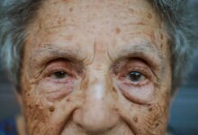 اكتشف العلماء السبب الرئيسي الذي يجعل العين المتقدمة في السن تكافح من أجل إعادة نمو الخلايا العصبية المفقودة