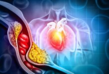 اكتشف العلماء مفتاحًا مخفيًا للكوليسترول يمكن أن يغير طريقة علاجنا لأمراض القلب