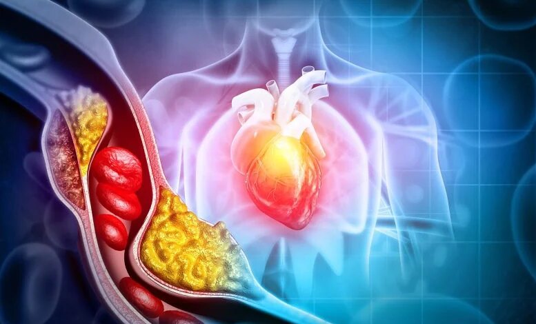 اكتشف العلماء مفتاحًا مخفيًا للكوليسترول يمكن أن يغير طريقة علاجنا لأمراض القلب