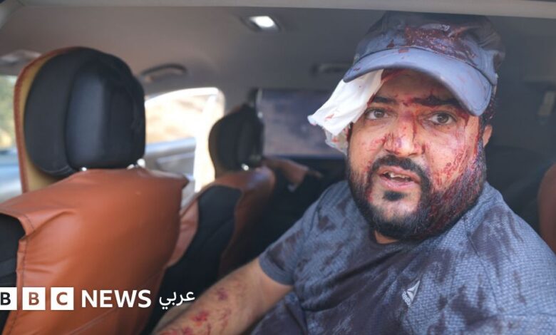 الضفة الغربية: إصابة فلسطينيين وصحفية أمريكية أثناء حصاد الزيتون