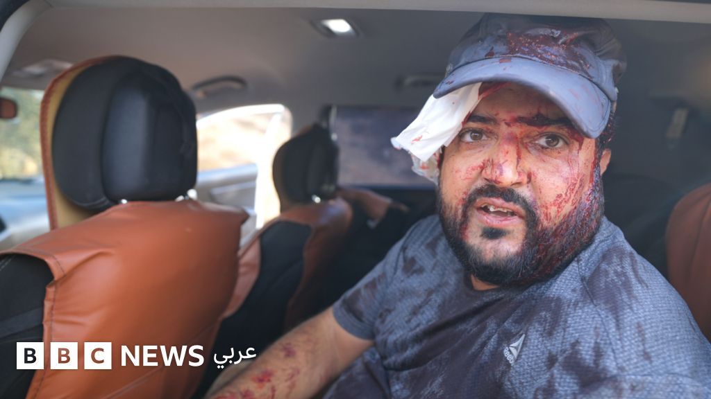 الضفة الغربية: إصابة فلسطينيين وصحفية أمريكية أثناء حصاد الزيتون