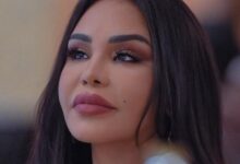 أحلام تفاجئ متابعيها بإجراء تجميلي في وجهها.. وتكشف النتيجة بنفسها