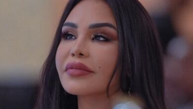 أحلام تفاجئ متابعيها بإجراء تجميلي في وجهها.. وتكشف النتيجة بنفسها